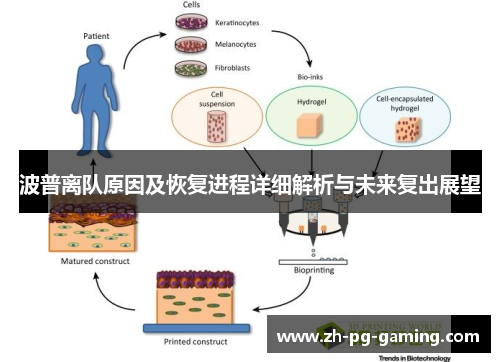 波普离队原因及恢复进程详细解析与未来复出展望